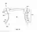 Fig. 27 - SPINAL SUPPORT DEVICE