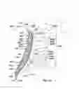 Fig. 30 - SPINAL SUPPORT DEVICE