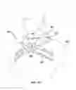Fig. 37 - SPINAL SUPPORT DEVICE