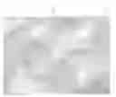 Fig. 01 - A DEVICE FOR ENHANCING AND/OR MAINTAINING A PENILE ERECTION