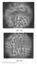 Fig. 14 - Methods and apparatus for therapeutic application of thermal energy including blood viscosity adjustment