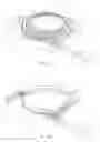 Fig. 02 - Apparatus and methods for treating excess intraocular fluid