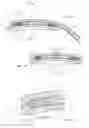 Fig. 04 - Apparatus and methods for treating excess intraocular fluid