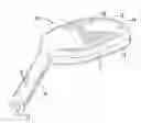 Fig. 01 - Apparatus for treating excess intraocular fluid