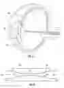 Fig. 03 - Apparatus for treating excess intraocular fluid