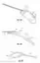 Fig. 08 - Apparatus for treating excess intraocular fluid