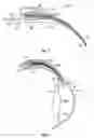 Fig. 03 - Intraocular drainage device
