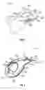 Fig. 04 - Intraocular drainage device