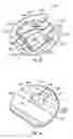 Fig. 08 - Intraocular drainage device