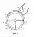 Fig. 04 - Intraocular implants and related kits and methods