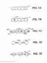 Fig. 08 - Intraocular implants and related kits and methods