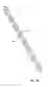 Fig. 22 - Intraocular implants and related kits and methods