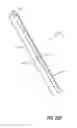 Fig. 40 - Intraocular implants and related kits and methods