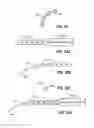 Fig. 44 - Intraocular implants and related kits and methods