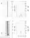 Fig. 40 - Method and apparatus to detect transponder tagged objects, for example during medical procedures