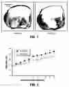 Fig. 03 - METHOD AND SYSTEM FOR PHYSICAL STIMULATION OF TISSUE