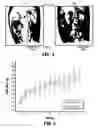 Fig. 04 - METHOD AND SYSTEM FOR PHYSICAL STIMULATION OF TISSUE