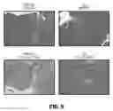 Fig. 09 - METHOD AND SYSTEM FOR PHYSICAL STIMULATION OF TISSUE