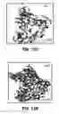 Fig. 16 - METHOD AND SYSTEM FOR PHYSICAL STIMULATION OF TISSUE