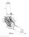 Fig. 07 - High Performance Free Rolling Cable Transmission