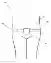 Fig. 01 - Automated Fundal Massager
