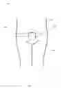 Fig. 02 - Automated Fundal Massager