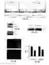 Fig. 10 - Treatment of solid tumours