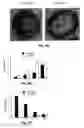 Fig. 12 - Treatment of solid tumours