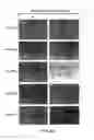 Fig. 06 - METHOD OF TREATING A MALIGNANCY IN A SUBJECT AND A PHARMACEUTICAL COMPOSITION FOR USE IN SAME
