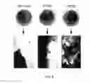 Fig. 09 - METHOD OF TREATING A MALIGNANCY IN A SUBJECT AND A PHARMACEUTICAL COMPOSITION FOR USE IN SAME