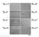 Fig. 07 - METHODS AND COMPOSITIONS FOR TREATING BRAIN DISEASES