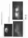Fig. 33 - AAV-MEDIATED GENE THERAPY FOR NPHP5 LCA-CILIOPATHY