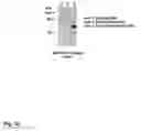 Fig. 83 - MODIFICATION OF RECOMBINANT ADENOVIRUS WITH IMMUNOGENIC PLASMODIUM CIRCUMSPOROZOITE PROTEIN EPITOPES