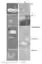 Fig. 06 - Nucleic acid constructs and gene therapy vectors for use in the treatment of Wilson disease