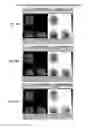Fig. 18 - THERAPY OF MALIGNANT NEOPLASIAS