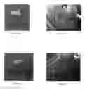 Fig. 08 - Hybrid material implant having variable porosity
