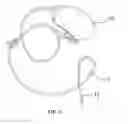 Fig. 02 - Guiding needle for suction tube