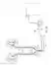 Fig. 35 - Ureteral and bladder catheters and methods of inducing negative pressure to increase renal perfusion