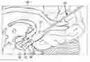 Fig. 01 - Hippocampal drug delivery devices and methods