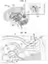Fig. 02 - Hippocampal drug delivery devices and methods