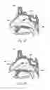Fig. 06 - APPARATUS AND METHODS FOR DILATING AND MODIFYING OSTIA OF PARANASAL SINUSES AND OTHER INTRANASAL OR PARANASAL STRUCTURES