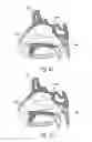 Fig. 08 - APPARATUS AND METHODS FOR DILATING AND MODIFYING OSTIA OF PARANASAL SINUSES AND OTHER INTRANASAL OR PARANASAL STRUCTURES