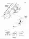 Fig. 02 - Neuromodulation with burst stimulation