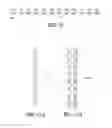 Fig. 07 - Customized priming by neuromodulation device