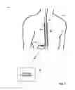 Fig. 02 - Automated verification of MRI compatibility of active implantable medical device