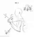 Fig. 10 - Exercise assisting device