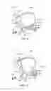 Fig. 06 - Weighted iron set