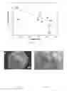 Fig. 06 - Application method and device for cold field plasma discharge assisted high energy ball milled powder