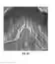 Fig. 09 - System and methods for deposition spray of particulate coatings