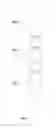 Fig. 07 - Processing method and apparatus for metal housing